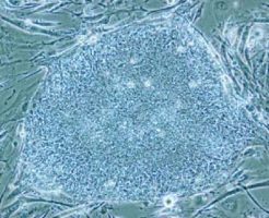 iPS細胞による網膜色素変性症治療の最新情報！